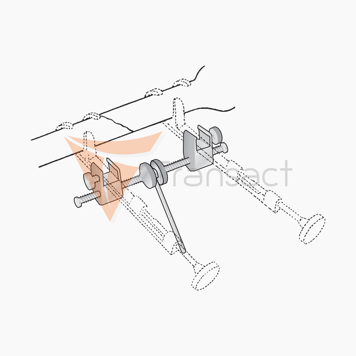 gerster-bone-holding-clamps